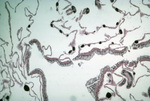 Histological Section, White Band Disease Colony A, Acropora palmata, Bonaire