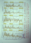 Line Graphs, Water Levels in Artesian and Nonartesian Aquifers of Florida, 1973-1974, Biscayne Aquifer